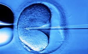 vitro_fertilisation
