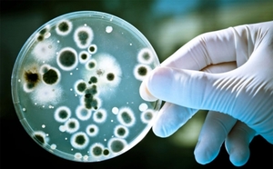 Бактериологический посев - выявленная гонорея