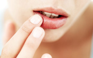 Возможные причины сухости губ