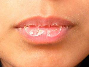 Как обеспечить защиту губ от негативных воздействий