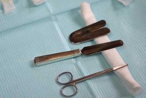 Недостатки и преимущества обрезания